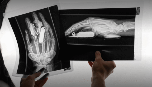 DeltaHub Carpio 2.0 radiografia